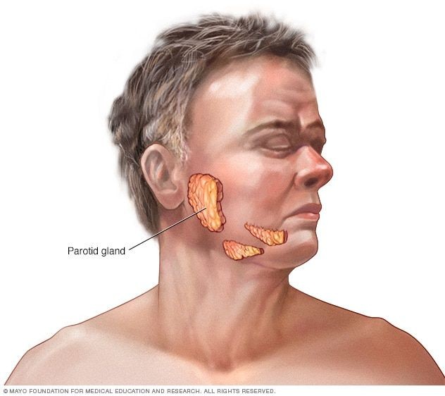 Parotid and salivary gland tumors image